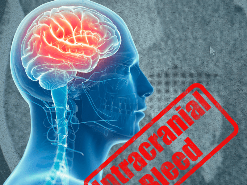 A Night in Stroke Care: Stability, Deterioration, and&nbsp;Reality